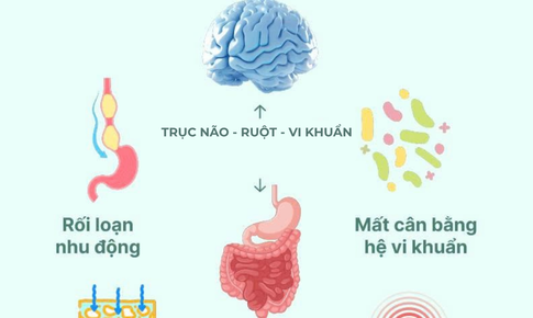 Hội chứng ruột kích thích – Giải pháp đột phá mới từ PHGG và Simethicone