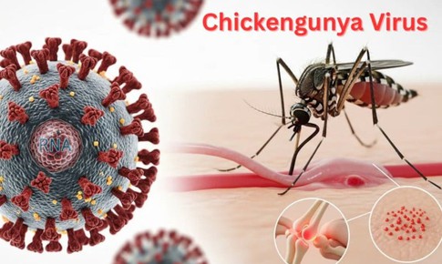 Muỗi đốt truyền bệnh Chikungunya lưu hành tại nhiều địa phương, Bộ Y tế nói gì về nguy cơ dịch bệnh này?