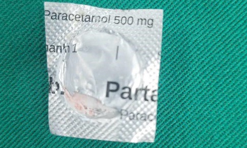 Uống viên thuốc còn nguyên vỏ cứng, người đàn ông bị tổn thương thực quản