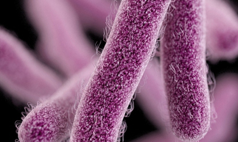 Pháp thu hồi phô mai mềm sau 2 ca tử vong nghi nhiễm khuẩn listeria