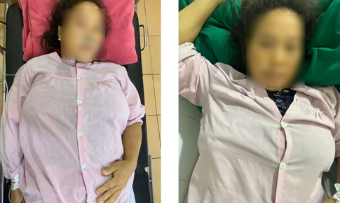Cảnh b&#225;o từ c&#226;u chuyện thai phụ người M&#244;ng ph&#225; thai bằng thuốc kh&#244;ng r&#245; nguồn gốc