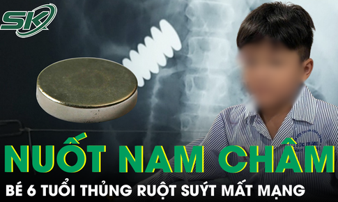 Nuốt 4 vi&#234;n nam ch&#226;m, b&#233; trai 6 tuổi ở Cần Thơ thủng ruột, su&#253;t mất mạng 