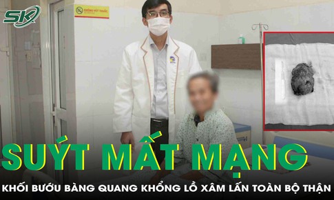 Tr&#236; ho&#227;n điều trị, người đ&#224;n &#244;ng su&#253;t mất mạng v&#236; khối bướu b&#224;ng quang khổng lồ x&#226;m lấn to&#224;n bộ thận