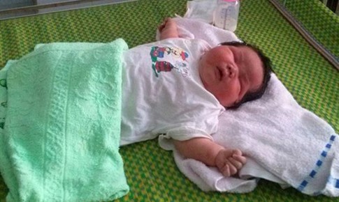 Nhận biết những dấu hiệu bất thường ở trẻ sơ sinh