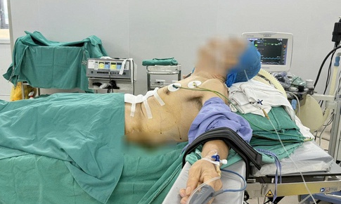 Bệnh nhân 'nửa nằm, nửa ngồi' trong ca phẫu thuật ung thư dạ dày