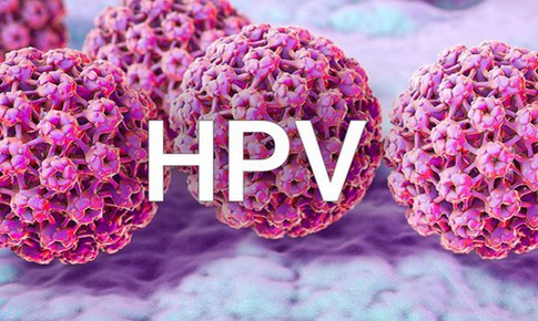 Nhiễm virus HPV c&#243; triệu chứng kh&#244;ng?