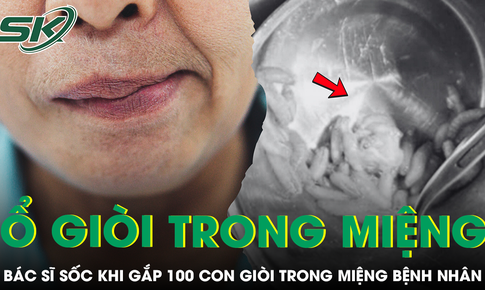 Bệnh nh&#226;n 69 tuổi nhập viện v&#236; kh&#243; thở, b&#225;c sĩ sốc khi ph&#225;t hiện hơn 100 con gi&#242;i trong miệng