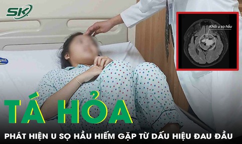 Cô gái 19 tuổi tá hoả phát hiện u sọ hầu hiếm gặp từ dấu hiệu mờ mắt, đau đầu
