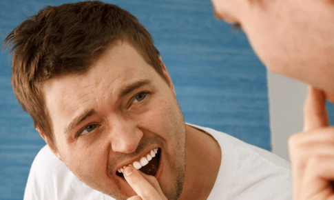 Răng lung lay - L&#224;m sao để chắc lại?