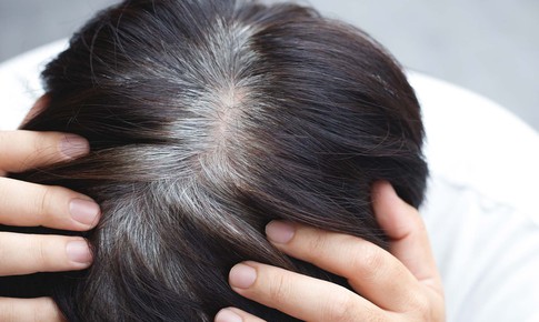 Vì sao tóc bạc sớm?