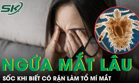Người phụ nữ H&#224; Nội sốc khi ph&#225;t hiện rận k&#253; sinh ngay tr&#234;n mi mắt