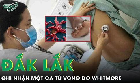 Th&#234;m một trường hợp tử vong do Whitmore tại Đắk Lắk