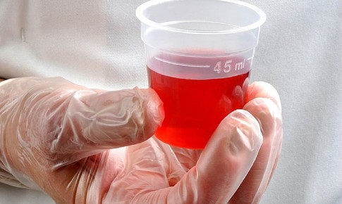 Những điều cần biết khi sử dụng methadon điều trị nghiện chất dạng thuốc phiện