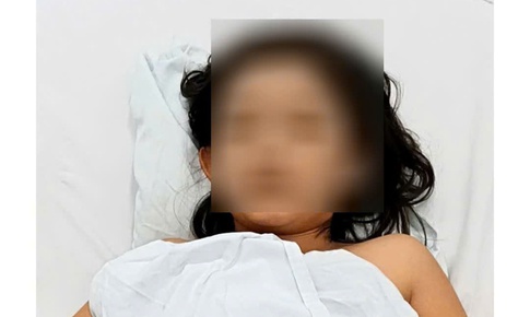 Bé gái bị hôn mê sau khi ăn ốc biển không rõ loại