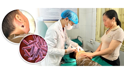 Cứu sống trẻ mắc bệnh Whitmore nguy hiểm