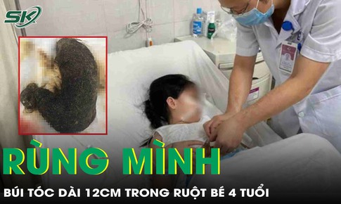Phẫu thuật lấy b&#250;i t&#243;c d&#224;i 12cm trong ruột b&#233; g&#225;i 4 tuổi