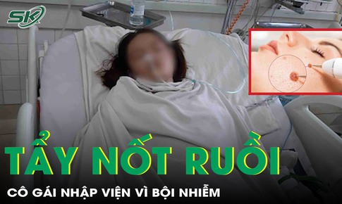 Tẩy nốt ruồi tại cơ sở thẩm mỹ chui, c&#244; g&#225;i nhập viện v&#236; bội nhiễm, đau nhức dữ dội