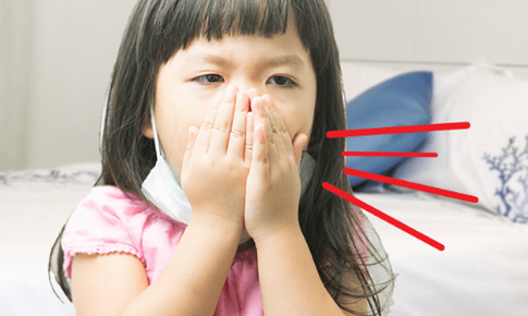Ho k&#233;o d&#224;i ở trẻ: Nguy&#234;n nh&#226;n thường gặp v&#224; c&#225;ch xử tr&#237; hiệu quả