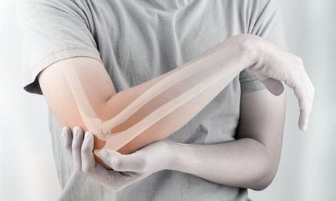 Loãng xương sớm - Dùng thuốc và phòng ngừa như thế nào?
