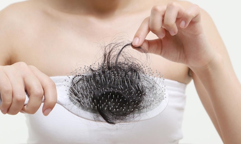 T&#243;c rụng nhiều khi tắm gội c&#243; bất thường?
