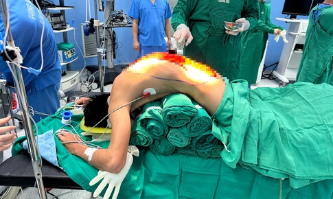 10 giờ phẫu thuật giải cứu người đàn ông 'cong như con tôm' , 7 năm cúi mặt xuống đất