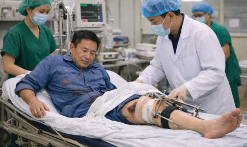 Cấp cứu kịp thời, bảo toàn chức năng vận động cho người đàn ông bị gãy xương đùi