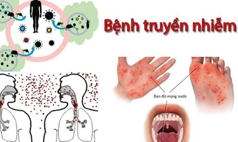 Dịch bệnh truyền nhiễm gia tăng, ngành Y tế Lâm Đồng tăng cường các biện pháp phòng, chống