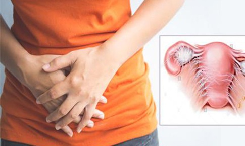 Đang viêm phần phụ có nên sinh hoạt tình dục?