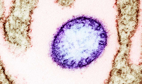 Những rào cản khiến virus Nipah chưa có vaccine