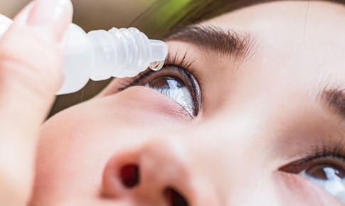 Làm gì khi mắc viêm kết mạc mùa xuân?