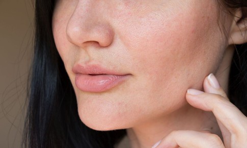 Ngứa ngáy da mặt, khó chịu, cảnh giác với nhiễm nấm