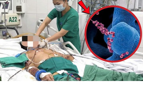 Người đàn ông 61 tuổi suy đa tạng, xuất huyết hoại tử vì thói quen phổ biến