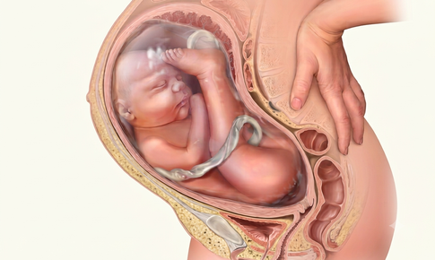 Thai nhi ngôi ngược: Nguyên nhân, xử trí và lựa chọn sinh nở an toàn