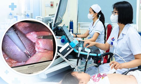 Bé gái 7 tuổi đau bụng dữ dội, bác sĩ phát hiện túi mật hoại tử