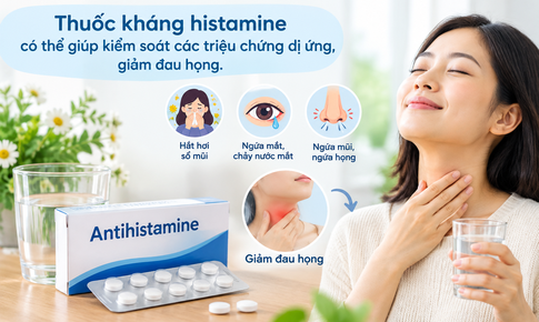 Đau họng uống thuốc gì? Cách giảm đau an toàn và khi nào cần đi khám?