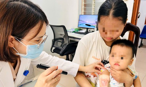 Viêm da do kiến ba khoang tăng ở Huế, cảnh báo việc tự chẩn đoán điều trị