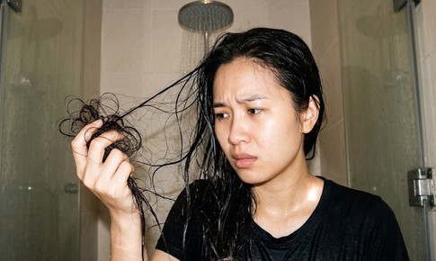 Rụng tóc bao nhiêu khi gội đầu là bình thường? 5 cách hạn chế rụng tóc