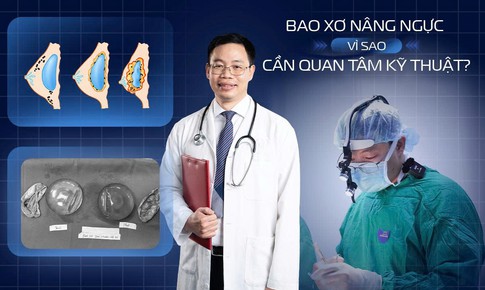 Bao xơ sau nâng ngực: Vì sao cần quan tâm đến kỹ thuật phẫu thuật?