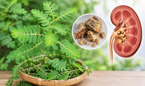 Cách dùng cây chó đẻ hỗ trợ điều trị sỏi tiết niệu