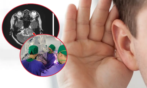 Đau đầu phát hiện khối u nằm ở vị trí nguy hiểm trong não 