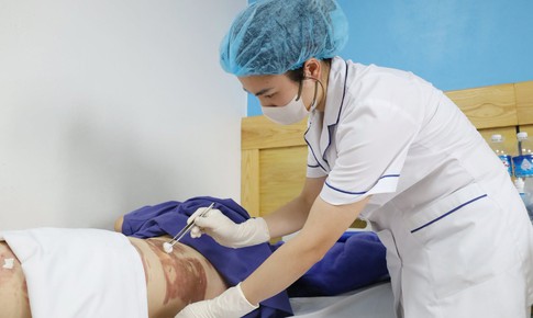 Đổ xăng khi đốt rác, người phụ nữ bị bỏng nhiều vùng trên cơ thể
