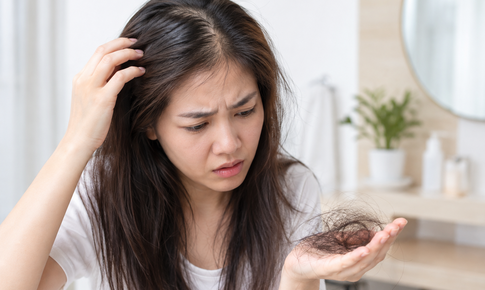 Viêm da tiết bã có gây rụng tóc?