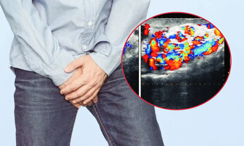 Nam giới 30 tuổi hiếm muộn, phát hiện nguyên nhân từ một bệnh lý ít triệu chứng