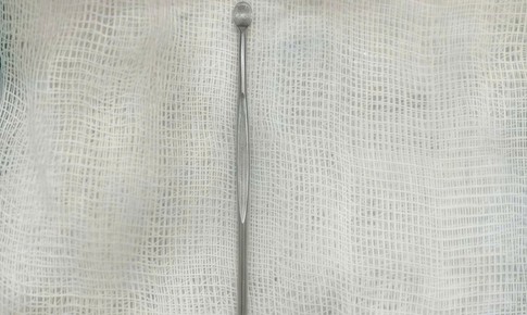 Bé trai 14 tuổi ở Hà Nội nhập viện vì dị vật dài 12cm trong niệu đạo