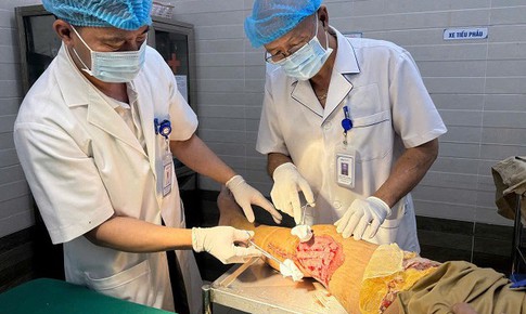 Ghép da tự thân phục hồi vận động cho bệnh nhân bỏng bô