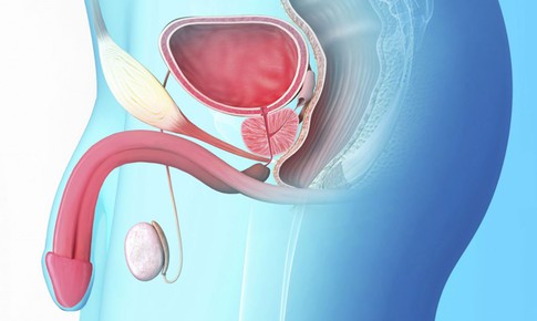 Phì đại tuyến tiền liệt ở nam giới lớn tuổi khi nào cần điều trị?
