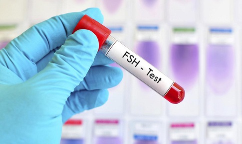 Mách bạn 7 cách tự nhiên giúp cân bằng nội tiết tố hiệu quả