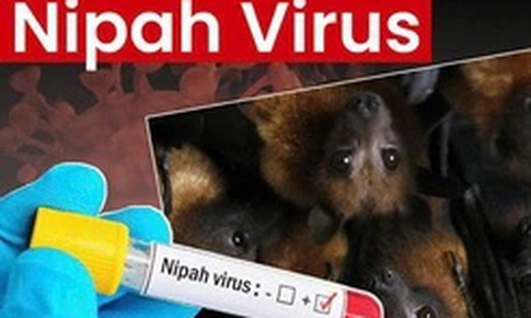 Bộ Y tế hướng dẫn chẩn đoán và điều trị bệnh truyền nhiễm do virus Nipah