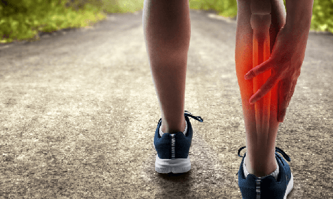 5 điều cần ghi nhớ để khắc phục những cơn đau nhức vùng cẳng chân