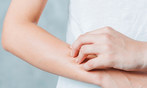 Bị dị ứng thời tiết nên làm gì?